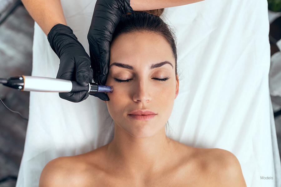 RF Microneedling treatment at Skin Lab Med Spa in Falls Church VA